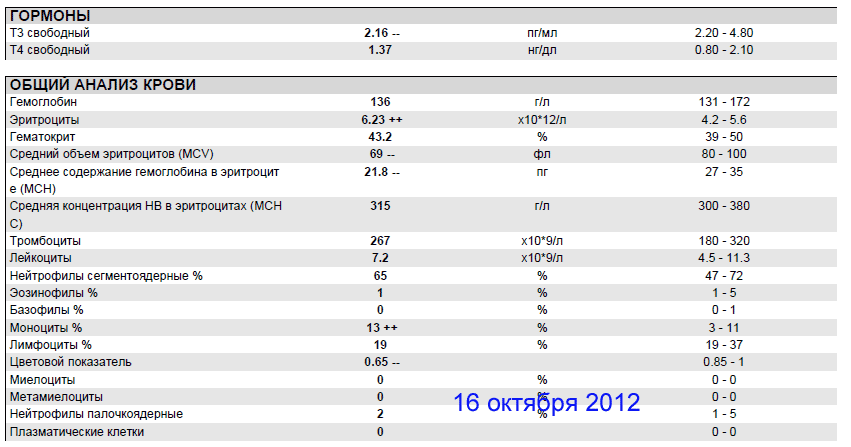 analis16.10.12.gif