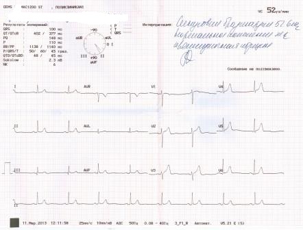 кардиограмма.jpg