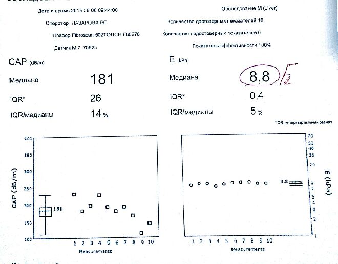 фиброскан .jpg