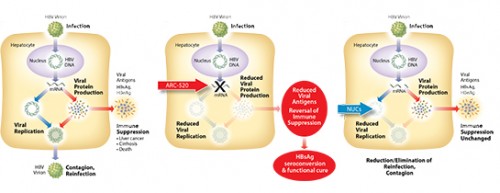 HBV_Diagrams.jpg