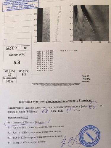 фибр1.04.16.jpg