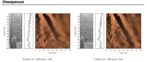 Картинка Measurements-5.8.jpg