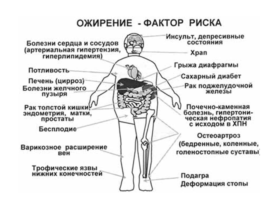 describe hypertension life style disease describe hypertension life style disease