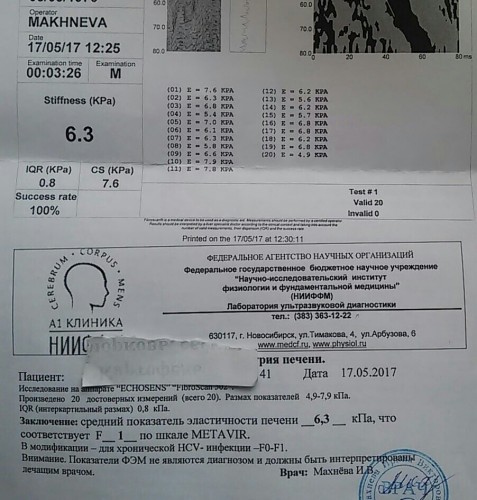 4,9-7,9 т.е. ф0-ф2 разброс