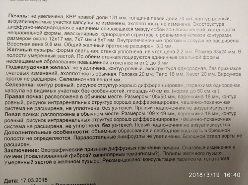узи