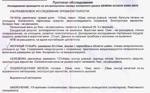узи.jpg