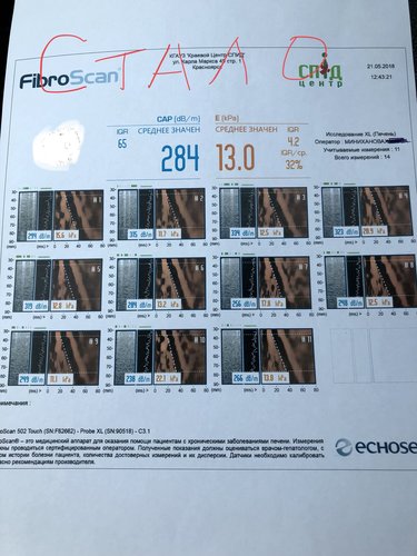 222D2EBA-2A56-4E1D-AF07-72D3AF781729.jpeg