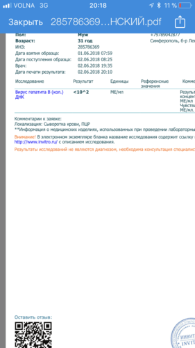 7B868B56-1355-4119-AAD9-11FDDBDBF549.png