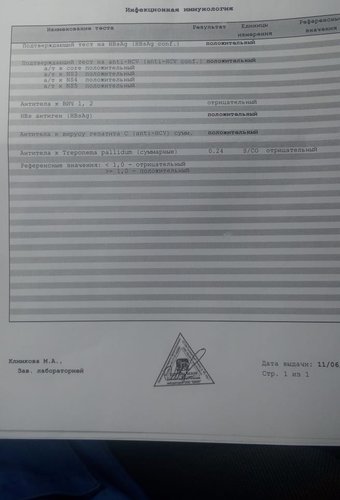 Вот этот анализ