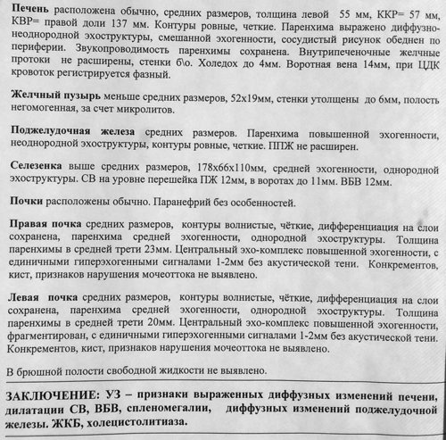 УЗИ