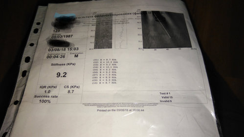 5796_markup.jpg