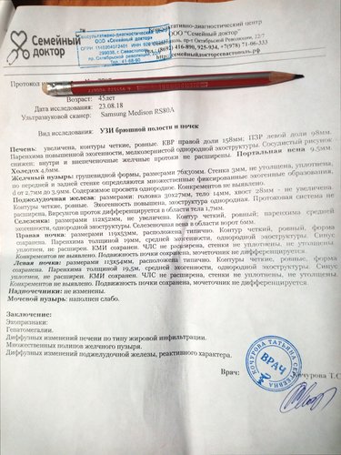 УЗИ