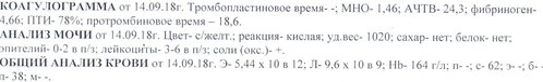 Без.jpg