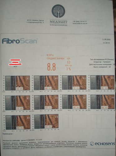 фскан.JPG