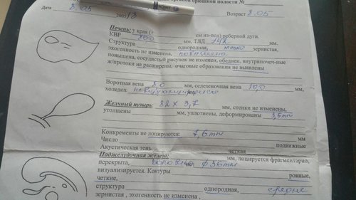 узи 05.jpg