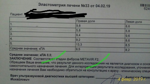 ... было 9.55кПа , стало 8.8