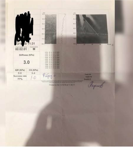 AB0D071B-3DDA-4DEF-BEFE-E7AD7F89FDE3.jpeg