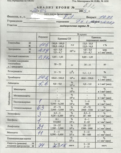 Спид начало ПВТ.jpg