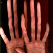 Пальцы  выросли, а он нет