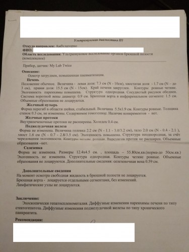 Узи