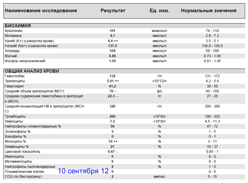 analis10.09.12.gif