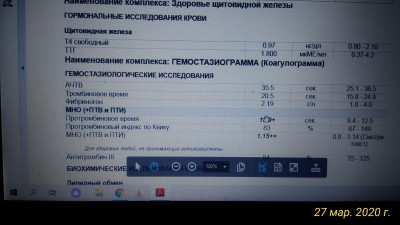 P_20200327_084737_p.jpg