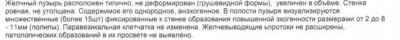 полипы.JPG