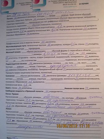 узи.JPG
