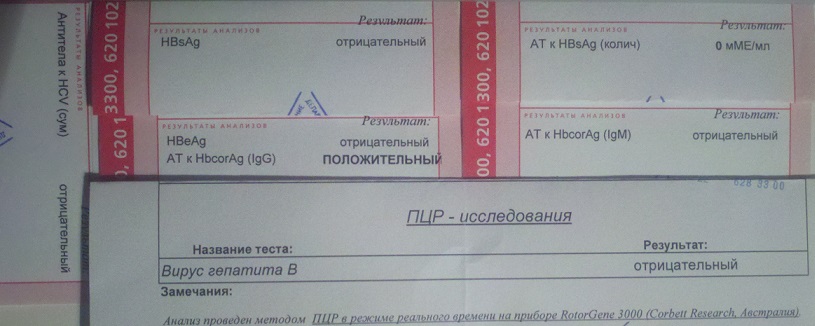 gep.jpg