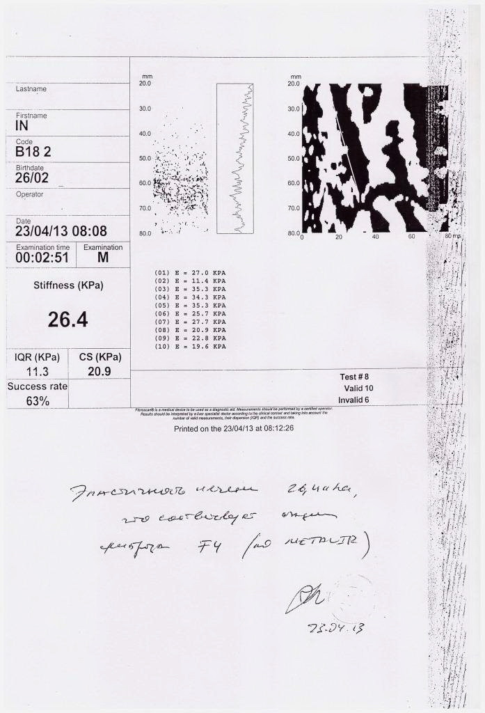 Фиброскан2.jpg