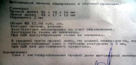 УЗИ щитовидки