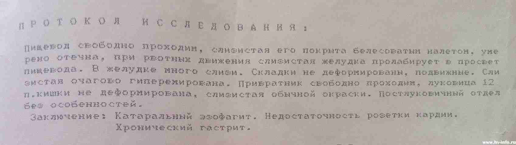 ФГС