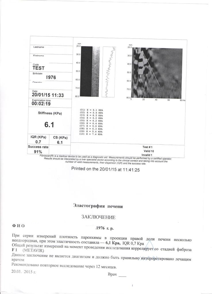 Фиброскан 20 января 2015 года но уже в другой клинике