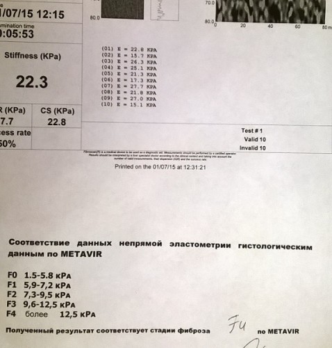 WP_20150805_10_19_05_Pro.jpg