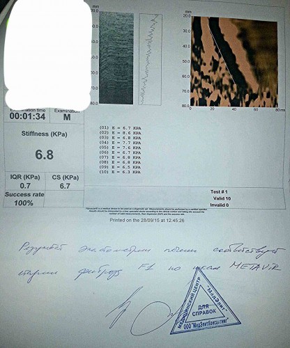 Фиброскан от 29.09.15