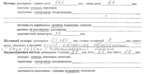 УЗИ