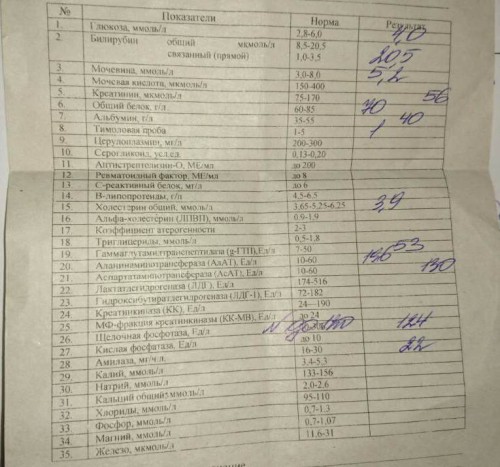 0-02-05-acdf13418a793ab8f477a5a3c120600c77e7e4b3b9383d558a3af78f732d9229_full.jpg