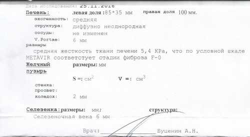 фиброскан, на УЗИ от 26.01.17 правая доля 130, все,что запомнила, сам результат УЗИ утеряла