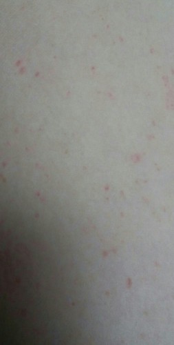 20170228_101039-1-1-1.jpg