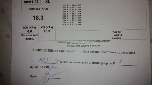 02/2016 вес 100 кг датчик XL