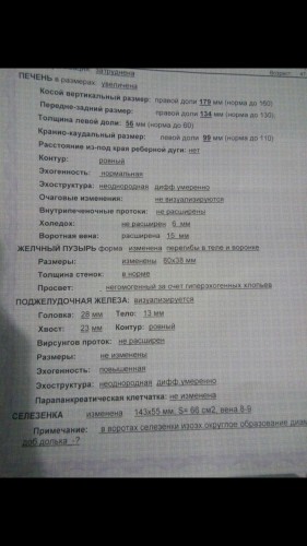 Узи