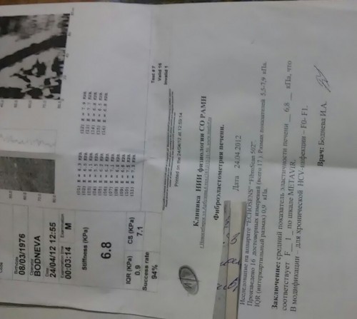 фиброскан апрель 2012.jpg