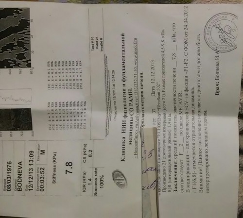 фиброскан декабрь 2013г.jpg