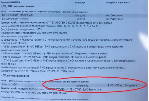 Анализ рнк что это. РНК вируса гепатита с количественное исследование. РНК ВИЧ количественный. HCV РНК обнаружено что это значит. РНК ВГC, генотип.