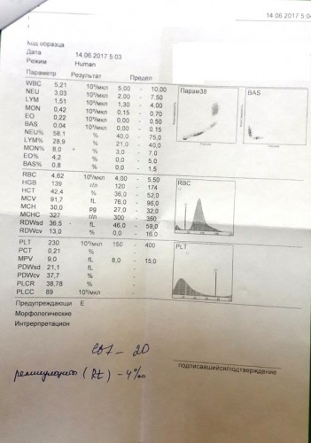 20170616_155245.jpg