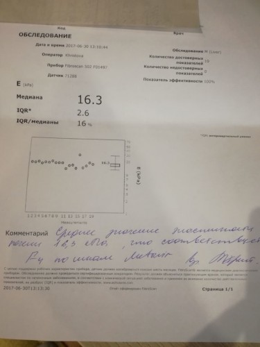 фиброскан 30 июня.jpg