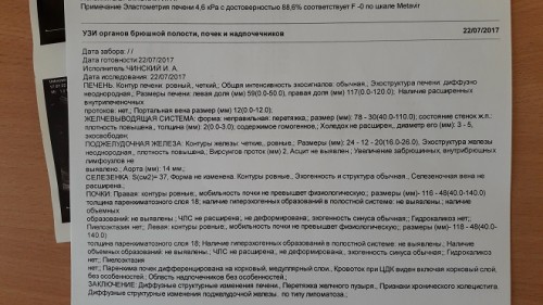20170724_194855.jpg
