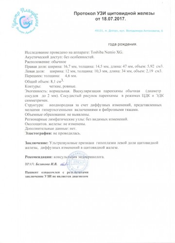 УЗИ щитовидки 18.07.17.jpg