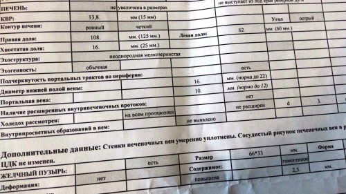 IMG-20170805-WA0004.jpg