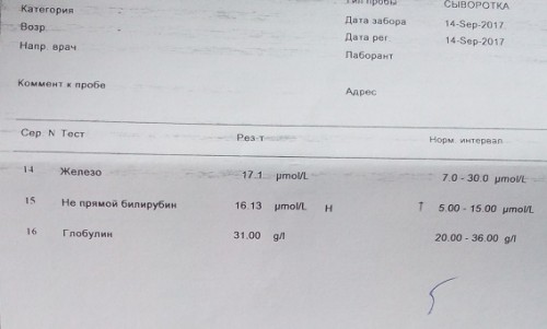 14.09.2017г. Железо, глобулин, не прямой билирубин.jpg